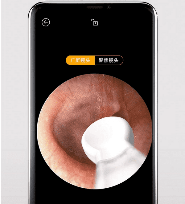 Пример видео с умной ушной палочки Xiaomi Bebird Smart Ear Cleaning Camera Endoscope X17 Pro